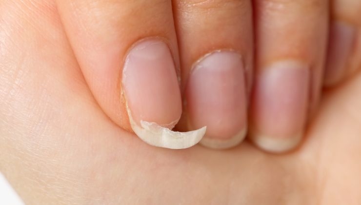 Come curare unghie fragili